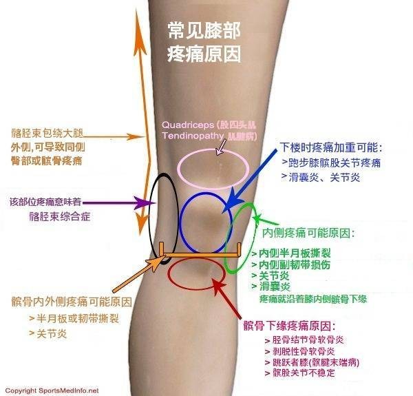 让你看清楚膝关节常见损伤及疼痛的原因